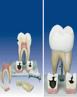  مدل اولین دندان آسیاب فک تحتانی
